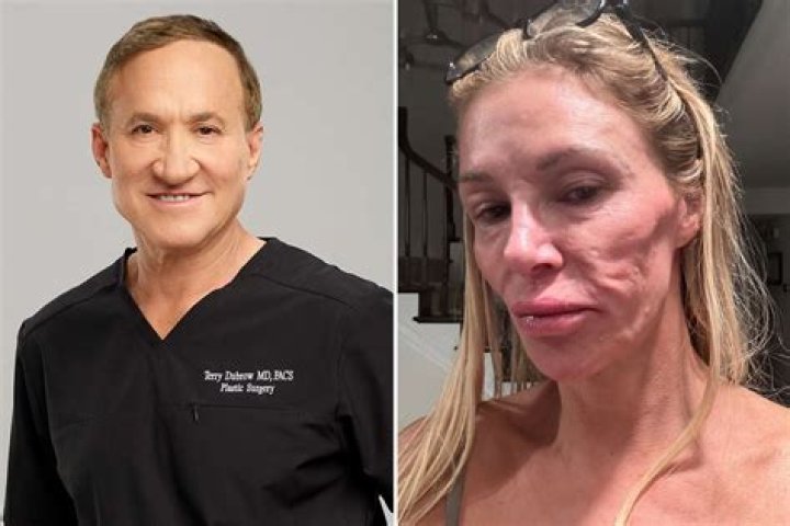 Did Nicole Sue Terry Dubrow? – Celebrity