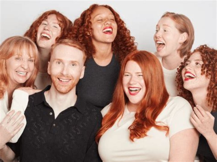 Why Do Redheads Have Yellow Teeth? – Celebrity